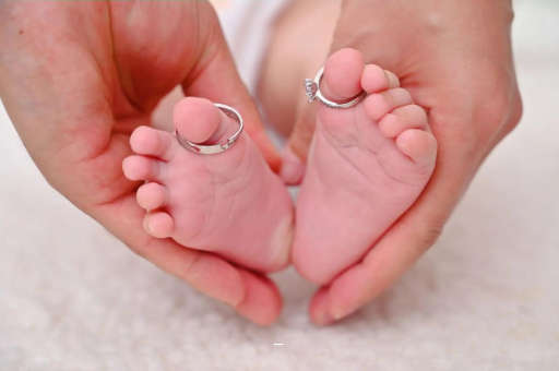 宁津怀孕妊娠线不明显